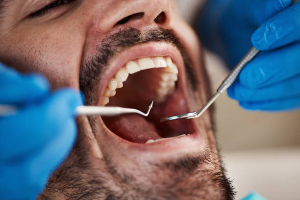 Best Emergency Orthodontic Repairs in Ferdand, IN